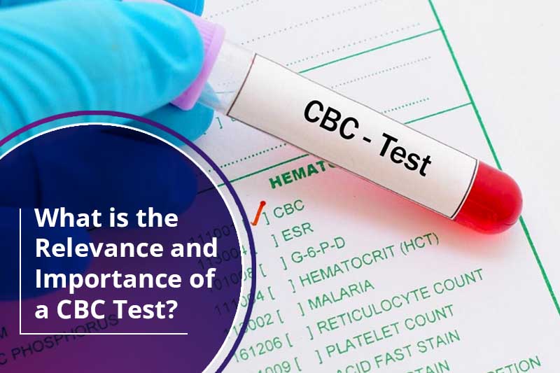 What is the relevance and importance of a CBC test?